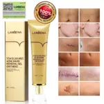 lanbena tcm,tcm scar and acne mark removal gel ointment,tcm scar and acne removal gel,tcm cream,lanbena scar removal review,tcm scar and acne mark removal gel,tcm scar removal gel,lanbena scar removal cream,tcm scar removal,lanbena acne scar removal cream,lanbena scar remover,tcm scar cream,tcm scar and acne mark,lanbena tcm scar and acne mark removal,tcm scar,tcm acne scar removal cream,tcm gel,lanbena tcm scar and acne mark removal gel ointment,tcm scar and acne mark removal,lanbena acne scar removal,scar and acne mark removal gel,tcm acne scar cream,lanbena scar removal stretch marks serum review,lanbena tcm gel ointment,tcm scar and acne removal gel ointment,lanbena scar removal cream review,tcm scar and acne removal gel fake,tcm scar removal cream,lanbena scar removal stretch marks cream review,tcm scar and acne removal,tcm scar and acne removal gel review,scar and acne mark removal gel ointment,lanbena scar cream,tcm scar and acne removal gel price,tcm scar and acne removal gel original,tcm scar removal in mercury drug,tcm scar and acne,tcm lanbena,tcm scar and acne marks removal gel,lan be na scar cream,tcm scar and acne mark removal gel ointment price,lanbena tcm scar and acne removal gel,tcm scar and acne mark removal gel ointment review,tcm scar and acne marks removal gel review,tcm scar and acne removal gel before and after,lanbena scar,lanbena acne scar removal serum review,lanbena scar and acne mark removal gel,lanbena ointment,manfaat lanbena tcm scar and acne mark removal gel ointment,tcm acne and scar removal gel,tcm scar and acne mark removal gel ointment original,tcm acne scar removal cream price,tcm acne scar removal,lanbena scar removal ingredients,tcm cream review,tcm scar gel,tcm cream price,tcm scar and acne removal cream,lanbena scar remover review,lanbena scar removal serum review,lanbena acne scar mark removal gel ointment,lanbena scar removal price,lanbena tcm scar,lanbena scar removal gel,tcm scar and acne removal gel ingredients,lanbena tcm scar removal gel,lanbena tcm scar and acne mark removal gel ointment ingredients,aliver tcm scar cream review,lanbena tcm scar and acne mark removal review,cara pakai tcm scar and acne mark removal gel ointment,tcm gel ointment,aliver tcm scar and acne mark removal gel ointment,tcm scar and acne removal ointment,lanbena scar removal gel review,manfaat tcm scar and acne mark removal gel ointment,tcm scar and acne mark removal gel review,tcm scar removal price,lanbena tcm review,lanbena tcm scar removal,tcm scar and acne mark removal gel ointment lanbena,original tcm scar cream,lanbena tcm scar and acne mark removal gel,tcm scar removal fake and original,lanbena tcm scar and acne mark removal gel ointment review,kegunaan tcm scar and acne mark removal gel ointment,tcm lanbena scar removal,lanbena tcm cream,lanbena acne scar,lanbena acne scar removal cream review,lanbena acne scar removal review,lanbena acne scar removal cream price,tcm scar and acne mark removal gel ointment prix,lanbena scar removal stretch marks serum watson,aliver tcm scar and acne removal gel,tcm scar and acne marks removal gel ointment,tcm scar and,lanbena gel ointment,tcm scar and acne mark removal ointment,lanbena tcm scar and acne mark removal gel review,lanbena acne gel review,lanbena tcm original,tcm scar and acne mark removal gel price,lanbena scar removal original,lanbena tcm website,lanbena scar and acne removal gel,tcm scar and acne mark removal gel ointment avis,lanbena tcm watson,tcm scar and acne removal gel lanbena,tcm scar acne mark removal gel,tcm scar removal gel ingredients,acne scar removal cream lanbena,tcm scar removal review,lanbena scar and acne mark removal gel ointment,lan be na scar gel,scar acne mark removing gel,lanbena tcm scar review,tcm gel review,tcm scar and acne mark removal review,harga tcm scar and acne mark removal gel ointment,aliver tcm scar removal gel,lanbena gel ointment review,tcm scar and mark removal gel ointment,tcm scar cream review,tcm acne mark removal gel,lanbena scar cream review,review lanbena scar,tcm lanbena scar eraser review,tcm acne scar removal gel,tcm scar removal cream review,tcm scar and acne mark removal gel ointment ingredients,scar & acne mark removal gel ointment,lanbena removal gel,tcm lanbena review,lanbena scar gel review,lanbena tcm gel ointment review,review lanbena tcm scar,tcm gel original,tcm scar removal gel ointment,lanbena tcm acne scar removal cream,lanbena tcm serum,tcm scar removal gel price,lanbena scar removal ointment,tcm scar gel review,review tcm scar and acne mark removal gel ointment,tcm acne scar,tcm removal gel,tcm scar and removal gel ointment,tcm acne and scar removal gel review,tcm scar and acne mark removal gel ointment deutsch,lan be na tcm scar and acne mark,lanbena scar serum review,tcm scar cream original,tcm acne mark removal gel ointment,lanbena acne scar remover,tcm lanbena cream,lanbena scar review,cara menggunakan tcm scar and acne mark removal gel ointment,fungsi tcm scar and acne mark removal gel ointment,lan be na cream,tcm acne scar cream review,tcm cream for scars,tcm lanbena original,lanbena tcm price,lanbena scar ointment,lanbena tcm scar remover,review lanbena acne scar,lanbena tcm stretch marks,tcm scar removal original