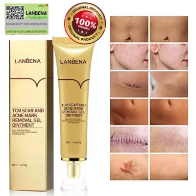 Online Shopping Sri Lanka | eshop Buy & Sell | eshop.lk 28 lanbena tcm,tcm scar and acne mark removal gel ointment,tcm scar and acne removal gel,tcm cream,lanbena scar removal review,tcm scar and acne mark removal gel,tcm scar removal gel,lanbena scar removal cream,tcm scar removal,lanbena acne scar removal cream,lanbena scar remover,tcm scar cream,tcm scar and acne mark,lanbena tcm scar and acne mark removal,tcm scar,tcm acne scar removal cream,tcm gel,lanbena tcm scar and acne mark removal gel ointment,tcm scar and acne mark removal,lanbena acne scar removal,scar and acne mark removal gel,tcm acne scar cream,lanbena scar removal stretch marks serum review,lanbena tcm gel ointment,tcm scar and acne removal gel ointment,lanbena scar removal cream review,tcm scar and acne removal gel fake,tcm scar removal cream,lanbena scar removal stretch marks cream review,tcm scar and acne removal,tcm scar and acne removal gel review,scar and acne mark removal gel ointment,lanbena scar cream,tcm scar and acne removal gel price,tcm scar and acne removal gel original,tcm scar removal in mercury drug,tcm scar and acne,tcm lanbena,tcm scar and acne marks removal gel,lan be na scar cream,tcm scar and acne mark removal gel ointment price,lanbena tcm scar and acne removal gel,tcm scar and acne mark removal gel ointment review,tcm scar and acne marks removal gel review,tcm scar and acne removal gel before and after,lanbena scar,lanbena acne scar removal serum review,lanbena scar and acne mark removal gel,lanbena ointment,manfaat lanbena tcm scar and acne mark removal gel ointment,tcm acne and scar removal gel,tcm scar and acne mark removal gel ointment original,tcm acne scar removal cream price,tcm acne scar removal,lanbena scar removal ingredients,tcm cream review,tcm scar gel,tcm cream price,tcm scar and acne removal cream,lanbena scar remover review,lanbena scar removal serum review,lanbena acne scar mark removal gel ointment,lanbena scar removal price,lanbena tcm scar,lanbena scar removal gel,tcm scar and acne removal gel ingredients,lanbena tcm scar removal gel,lanbena tcm scar and acne mark removal gel ointment ingredients,aliver tcm scar cream review,lanbena tcm scar and acne mark removal review,cara pakai tcm scar and acne mark removal gel ointment,tcm gel ointment,aliver tcm scar and acne mark removal gel ointment,tcm scar and acne removal ointment,lanbena scar removal gel review,manfaat tcm scar and acne mark removal gel ointment,tcm scar and acne mark removal gel review,tcm scar removal price,lanbena tcm review,lanbena tcm scar removal,tcm scar and acne mark removal gel ointment lanbena,original tcm scar cream,lanbena tcm scar and acne mark removal gel,tcm scar removal fake and original,lanbena tcm scar and acne mark removal gel ointment review,kegunaan tcm scar and acne mark removal gel ointment,tcm lanbena scar removal,lanbena tcm cream,lanbena acne scar,lanbena acne scar removal cream review,lanbena acne scar removal review,lanbena acne scar removal cream price,tcm scar and acne mark removal gel ointment prix,lanbena scar removal stretch marks serum watson,aliver tcm scar and acne removal gel,tcm scar and acne marks removal gel ointment,tcm scar and,lanbena gel ointment,tcm scar and acne mark removal ointment,lanbena tcm scar and acne mark removal gel review,lanbena acne gel review,lanbena tcm original,tcm scar and acne mark removal gel price,lanbena scar removal original,lanbena tcm website,lanbena scar and acne removal gel,tcm scar and acne mark removal gel ointment avis,lanbena tcm watson,tcm scar and acne removal gel lanbena,tcm scar acne mark removal gel,tcm scar removal gel ingredients,acne scar removal cream lanbena,tcm scar removal review,lanbena scar and acne mark removal gel ointment,lan be na scar gel,scar acne mark removing gel,lanbena tcm scar review,tcm gel review,tcm scar and acne mark removal review,harga tcm scar and acne mark removal gel ointment,aliver tcm scar removal gel,lanbena gel ointment review,tcm scar and mark removal gel ointment,tcm scar cream review,tcm acne mark removal gel,lanbena scar cream review,review lanbena scar,tcm lanbena scar eraser review,tcm acne scar removal gel,tcm scar removal cream review,tcm scar and acne mark removal gel ointment ingredients,scar & acne mark removal gel ointment,lanbena removal gel,tcm lanbena review,lanbena scar gel review,lanbena tcm gel ointment review,review lanbena tcm scar,tcm gel original,tcm scar removal gel ointment,lanbena tcm acne scar removal cream,lanbena tcm serum,tcm scar removal gel price,lanbena scar removal ointment,tcm scar gel review,review tcm scar and acne mark removal gel ointment,tcm acne scar,tcm removal gel,tcm scar and removal gel ointment,tcm acne and scar removal gel review,tcm scar and acne mark removal gel ointment deutsch,lan be na tcm scar and acne mark,lanbena scar serum review,tcm scar cream original,tcm acne mark removal gel ointment,lanbena acne scar remover,tcm lanbena cream,lanbena scar review,cara menggunakan tcm scar and acne mark removal gel ointment,fungsi tcm scar and acne mark removal gel ointment,lan be na cream,tcm acne scar cream review,tcm cream for scars,tcm lanbena original,lanbena tcm price,lanbena scar ointment,lanbena tcm scar remover,review lanbena acne scar,lanbena tcm stretch marks,tcm scar removal original