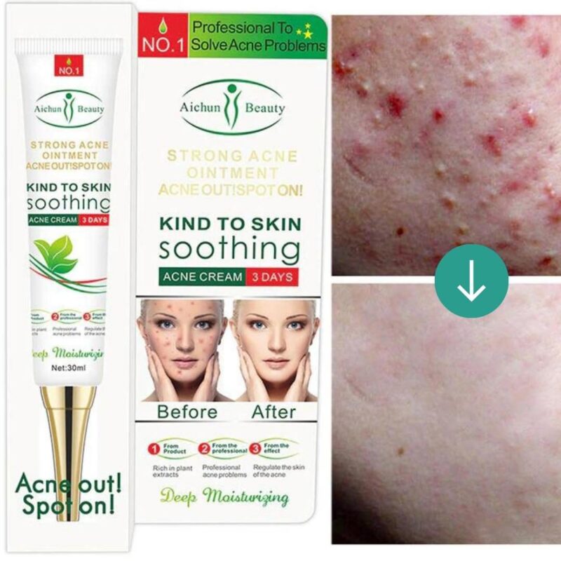 Aichun Beauty Acne Cleaning Face Repairing Cream with Skin Care and Deep Moisturizing