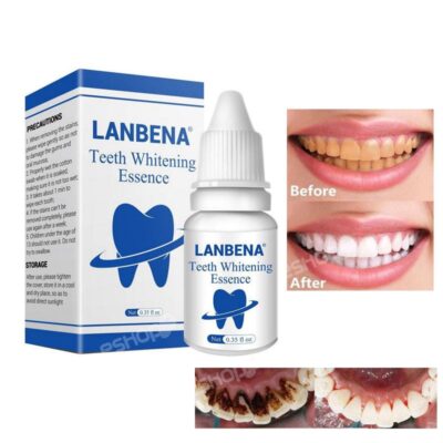 Online Shopping Sri Lanka | eshop Buy & Sell | eshop.lk 39 Lanbena teeth whitening