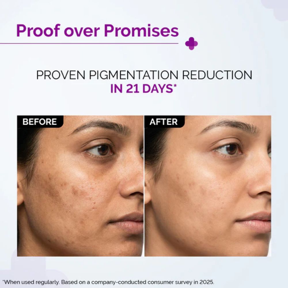 The Derma Co 2% Kojic Acid Face Serum with 1% Alpha Arbutin for Pigmentation 30ml 4 The Derma Co 2% Kojic Acid Face Serum with 1% Alpha Arbutin for Pigmentation 30ml - Image 4
