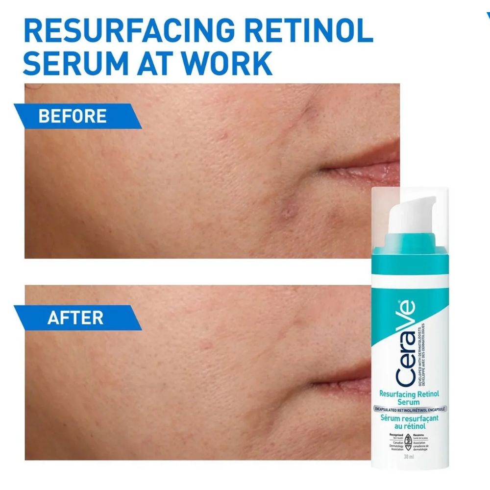 CeraVe Resurfacing Retinol Serum for Post-Acne Marks 30ml 3 CeraVe Resurfacing Retinol Serum for Post-Acne Marks 30ml - Image 3